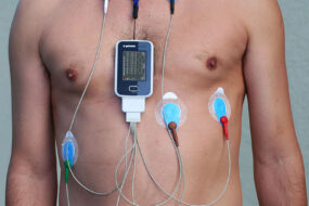 Telemedicina – Holter Cardiaco Pressorio
